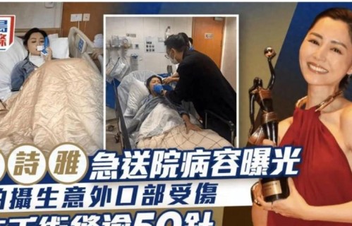 突发！知名女演员意外重伤！缝合超50针，经纪公司：已全面停工